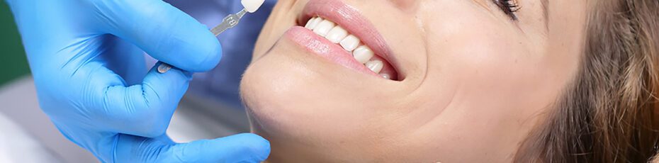 Porcelain Veneers in Main Street